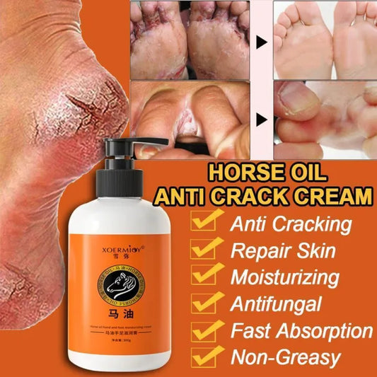 Anti Crack Foot Cream