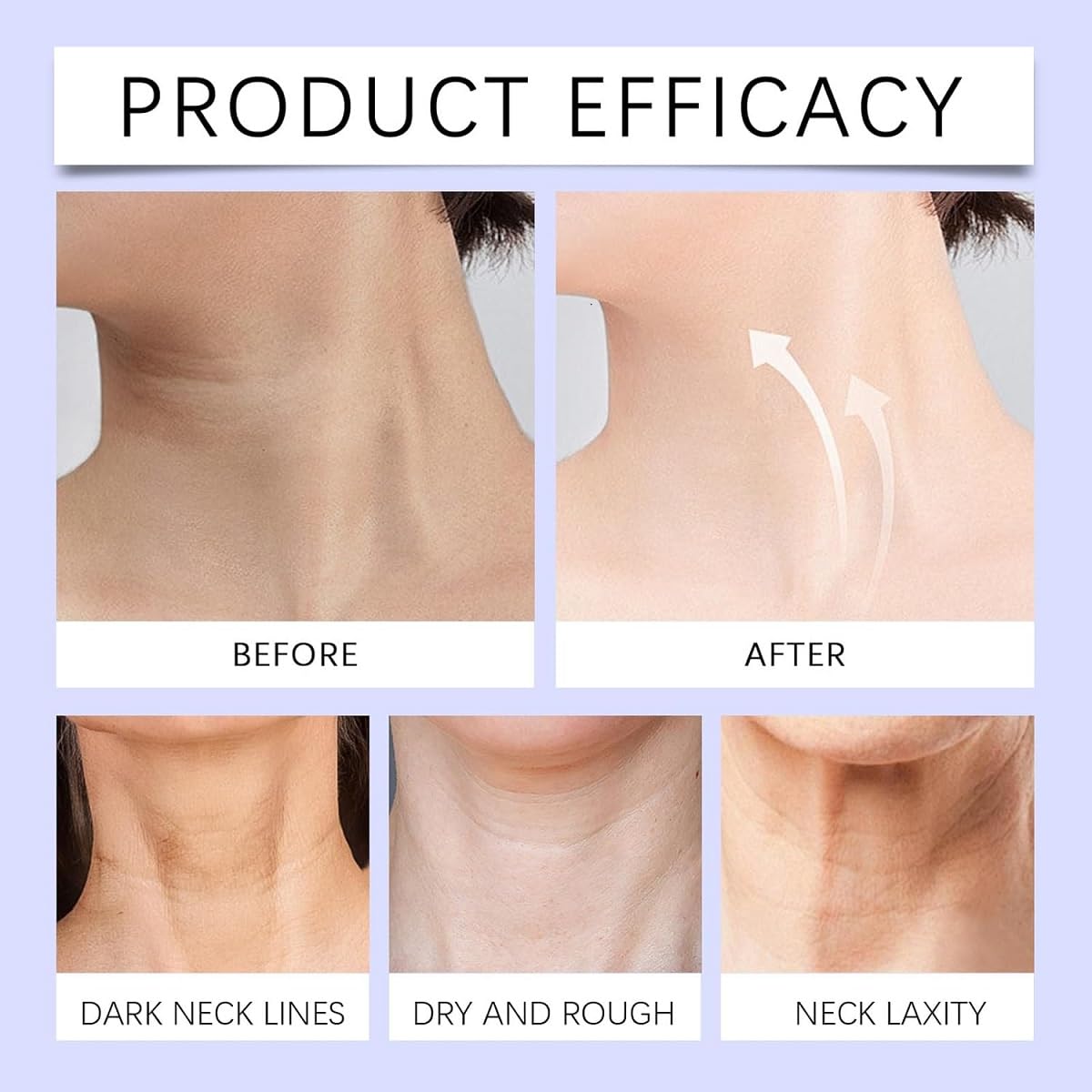 Skin Tighten & Lift Neck Cream ( Buy 1 Get 1 Free )