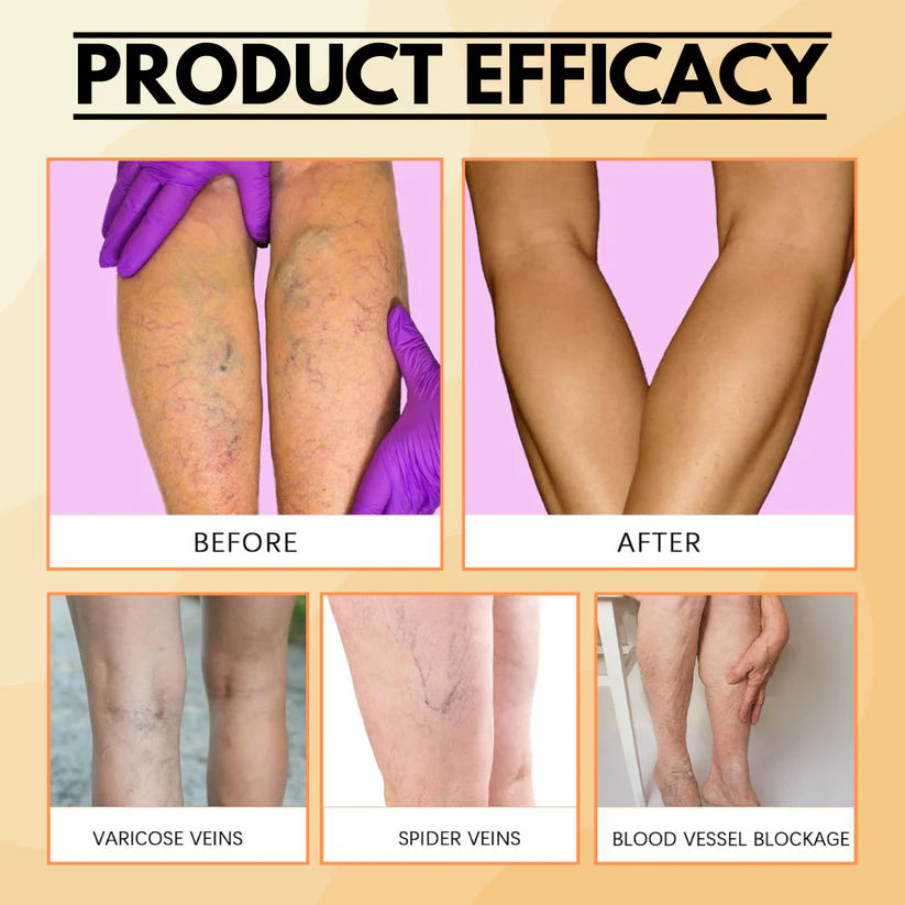 Turmeric Instant Relief – Varicose Veins Patch (Pack of 12 Patches)