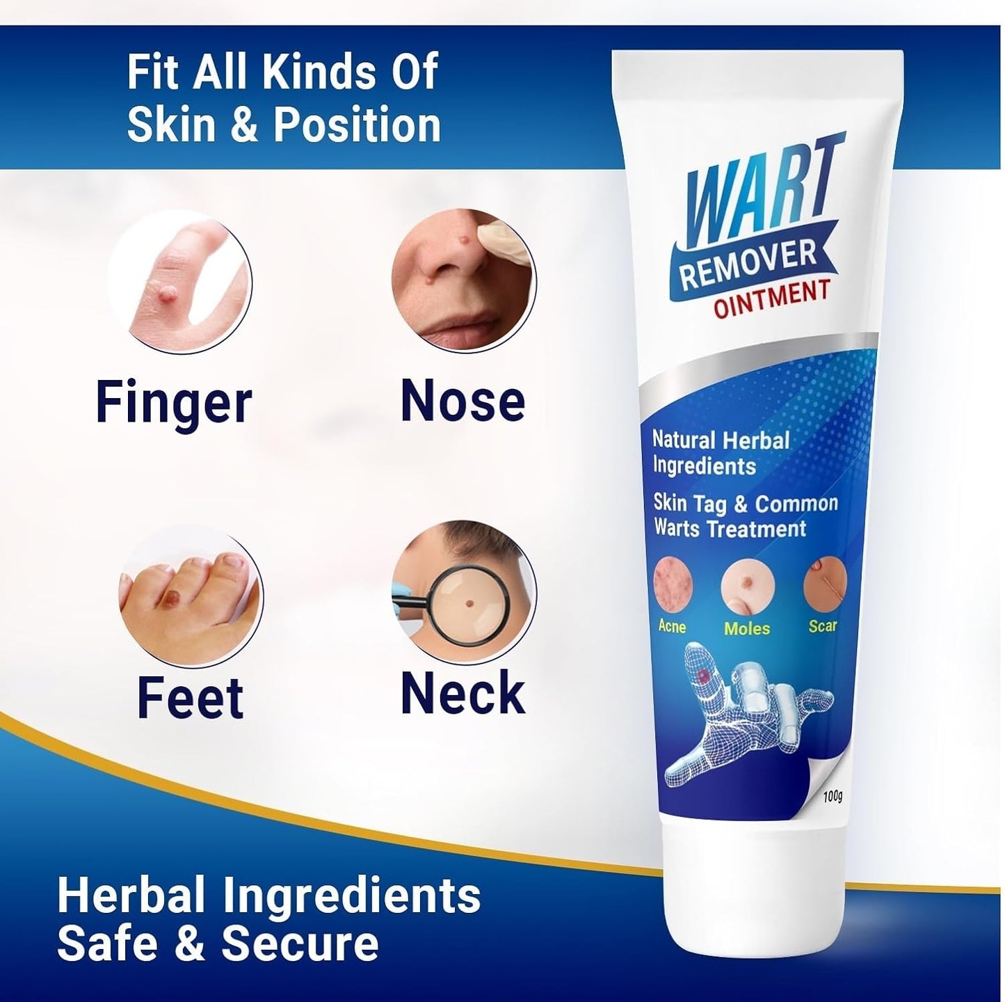 Medical Wart & Mole Remover Ointment (BUY 1 GET 1 FREE)