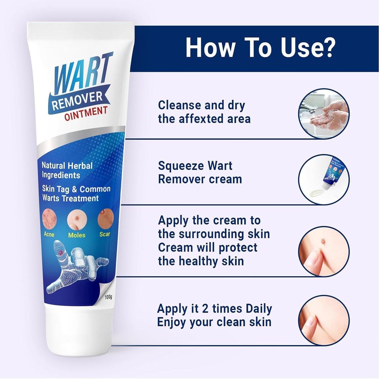 Medical Wart & Mole Remover Ointment (BUY 1 GET 1 FREE)