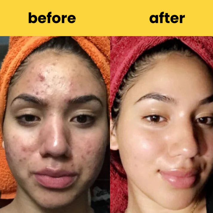 Turmeric Cleansing Pads – (Powered by Kojic Acid & Retinol) (60 Pads)