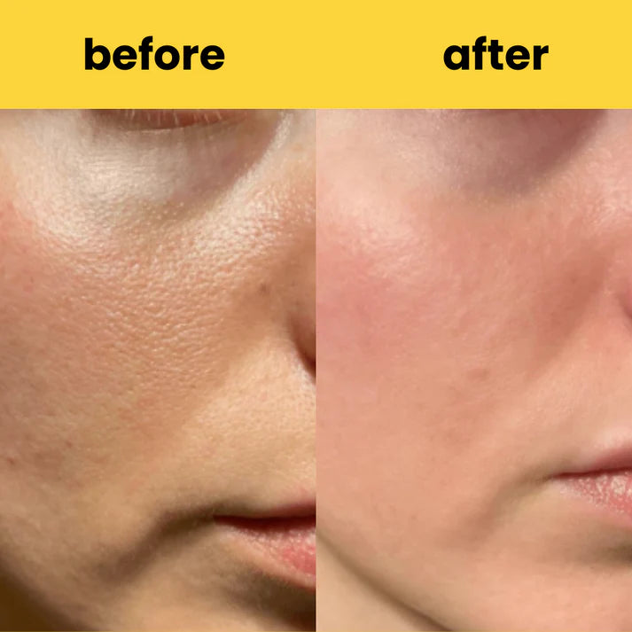 Turmeric Cleansing Pads – (Powered by Kojic Acid & Retinol) (60 Pads)