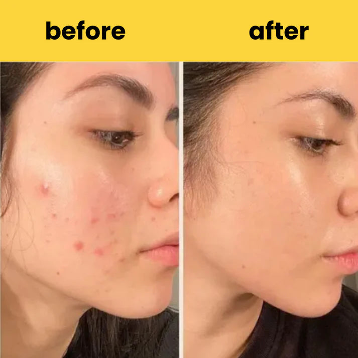 Turmeric Cleansing Pads – (Powered by Kojic Acid & Retinol) (60 Pads)