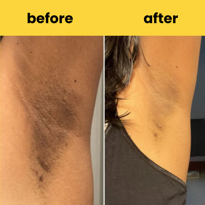 Turmeric Cleansing Pads – (Powered by Kojic Acid & Retinol) (60 Pads)