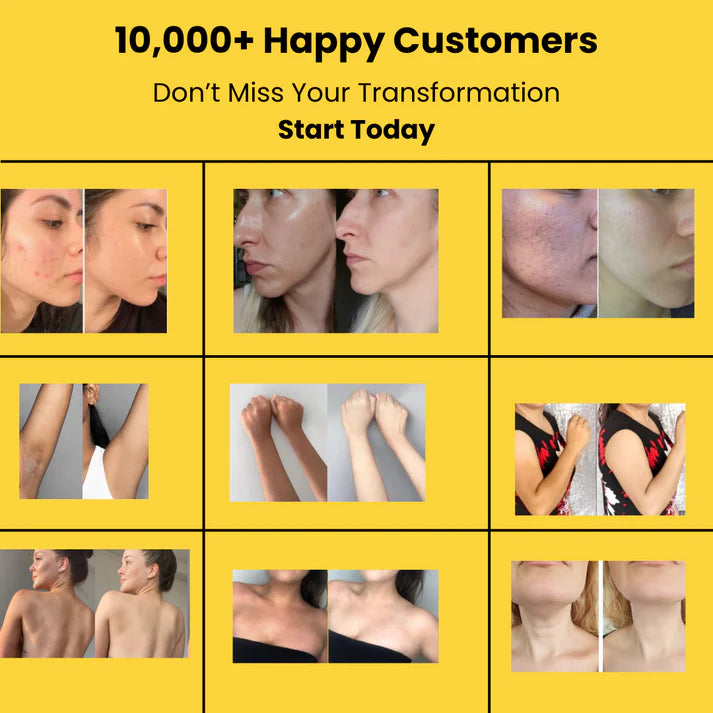 Turmeric Cleansing Pads – (Powered by Kojic Acid & Retinol) (60 Pads)