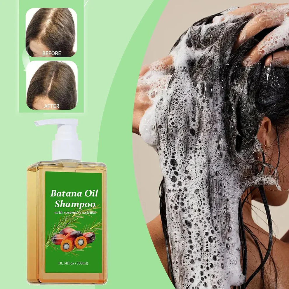 (BUY 1 GET 1 FREE) BATANA® Original Oil Shampoo with Rosemary Extract
