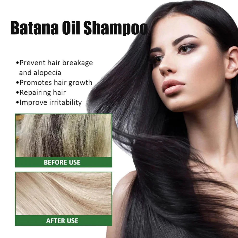 (BUY 1 GET 1 FREE) BATANA® Original Oil Shampoo with Rosemary Extract