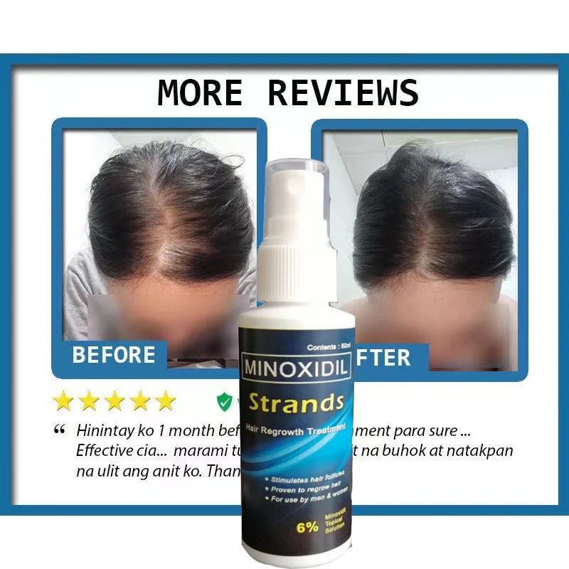 Minoxidil Strands Hair Regrowth Treatment 60ml (Pack of 2)