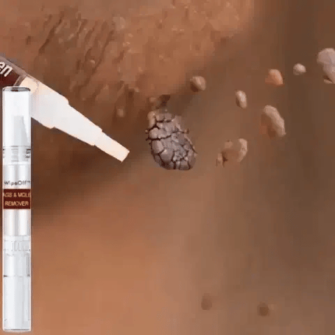 ClearSpot™ Tags & Moles Remover