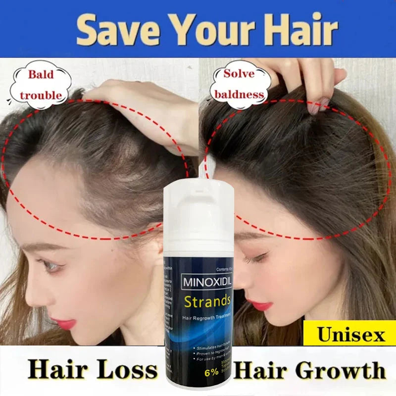Minoxidil Strands Hair Regrowth Treatment 60ml (Pack of 2)